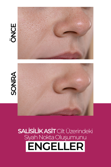 Nemlendirici Cilt Yenileyici Leke Karşıtı Krem 50ML - 4